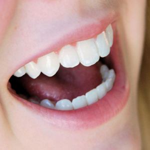 a woman's laughing mouth