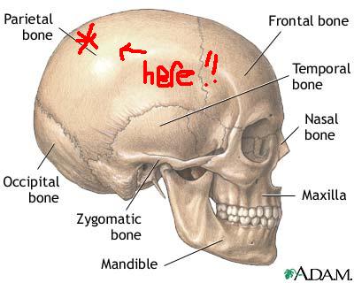 A diagram of a skull, with a marker at the parietal bone which is near the top back of the skull