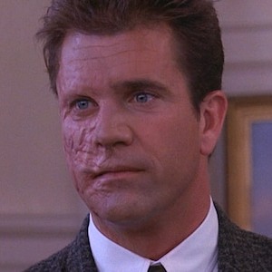 Mel Gibson with a disfigured face, from the movie The Man Without a Face